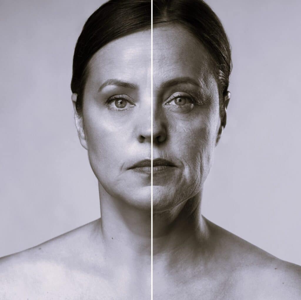 Avant après resultat de soins anti rides lifting sur le visage d'une femme